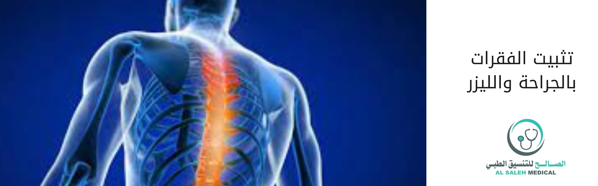 عملية تثبيت فقرات العمود الفقري في الهند بخبرات 